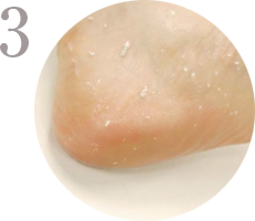 STEP3